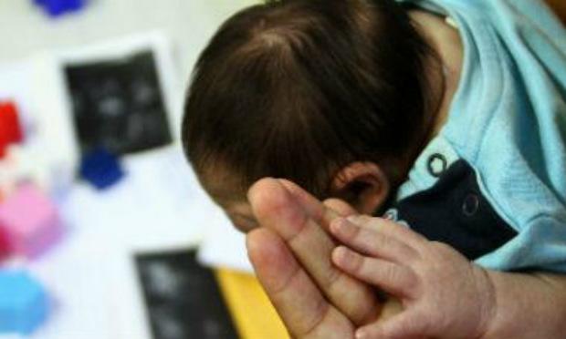 Crianças com diagnóstico de microcefalia têm direito à benefício / Foto: JC Imagem.