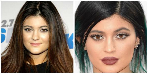 O antes e depois de Kylie