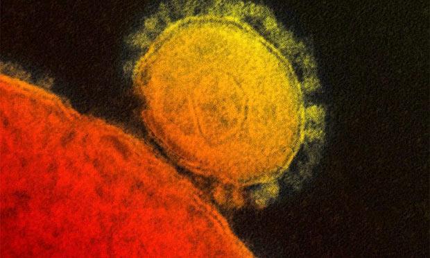 O coronavírus MERS é considerado um parente mais mortal, mas menos contagioso, do vírus que causa a síndrome respiratória aguda grave (Sars) / Foto: divulgação