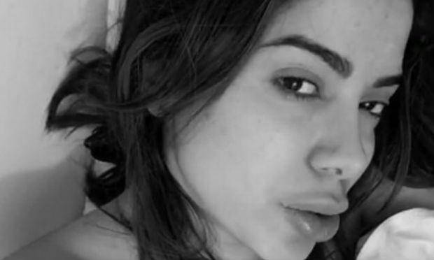 Anitta publicou foto com lábios inchados / Foto: Reprodução / Snapchat